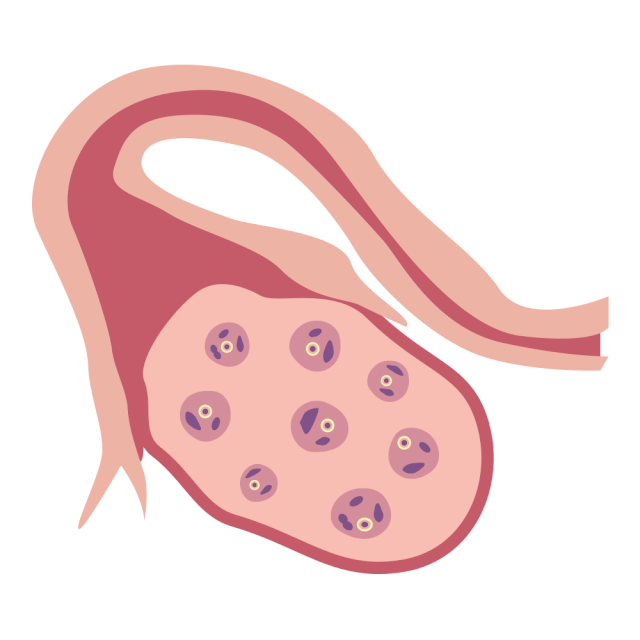 卵巢卵泡