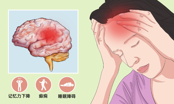 癫痫